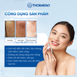 [LP] Kem Nám Ốc Sên Thorakao 30G