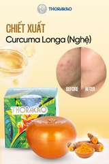Kem nghệ giảm thâm sẹo Thorakao 7g