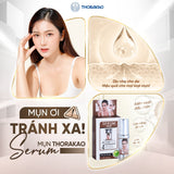 Serum Mụn Thorakao Giảm Mụn Cân Bằng Độ Ẩm Da 7G