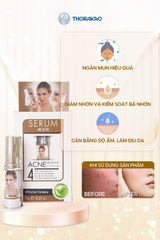 Serum dưỡng ẩm ngừa mụn Thorakao 7g